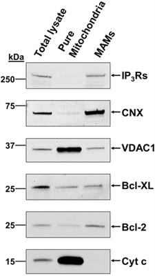 Modulation of Ca2+ Signaling by Anti-apoptotic B-Cell Lymphoma 2 Proteins at the Endoplasmic Reticulum–Mitochondrial Interface